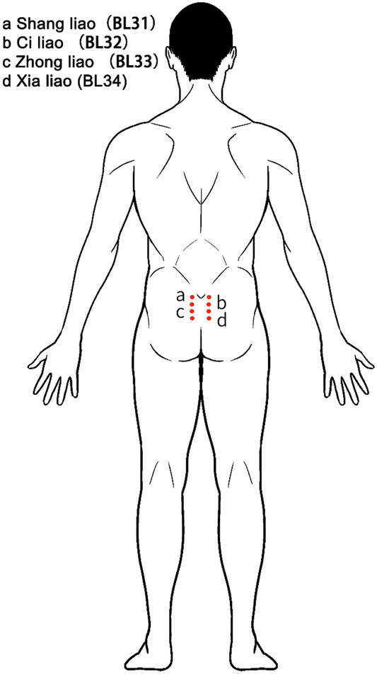 Cold Buttocks? Try Moxibustion on the Baliao Points Joy Garden Moxa