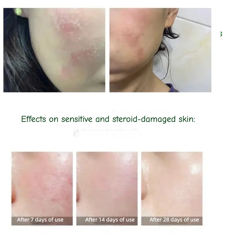Before and after skin repair with Joy Garden Aloe Vera Gel – refreshing and non-sticky after-sun care