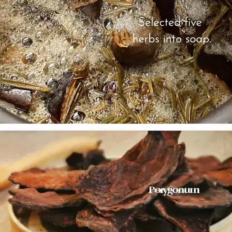 He Shou Wu Shampoo Bar for Buzz Cuts & Thinning Hair - Not for Oily Scalp (Lower Potency than Liquid Version)